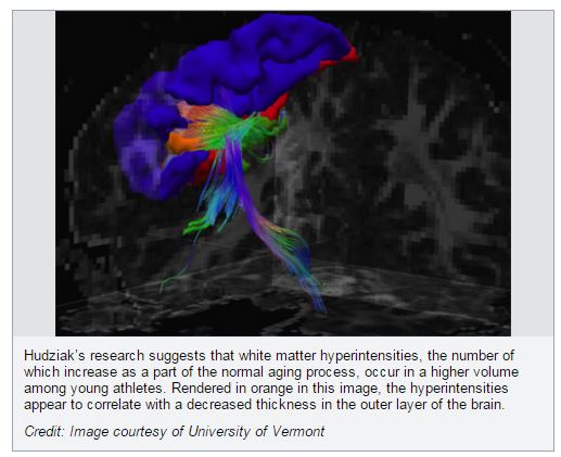 brainscan