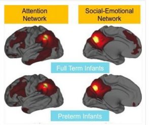 brainconnections