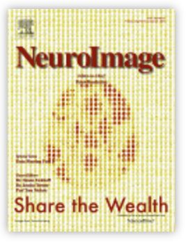 neuroimage